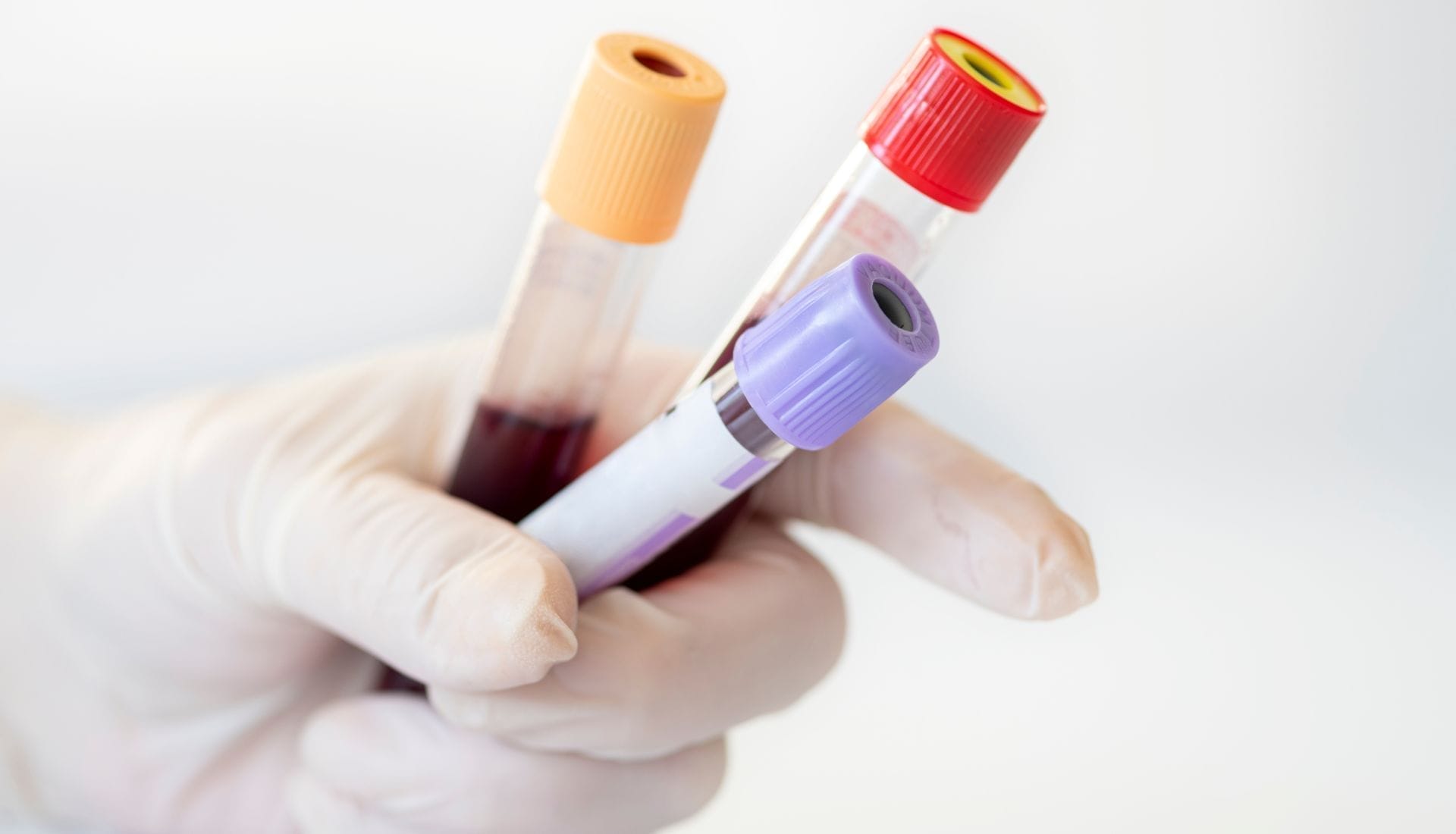 Gloved hand holding blood sample vials.