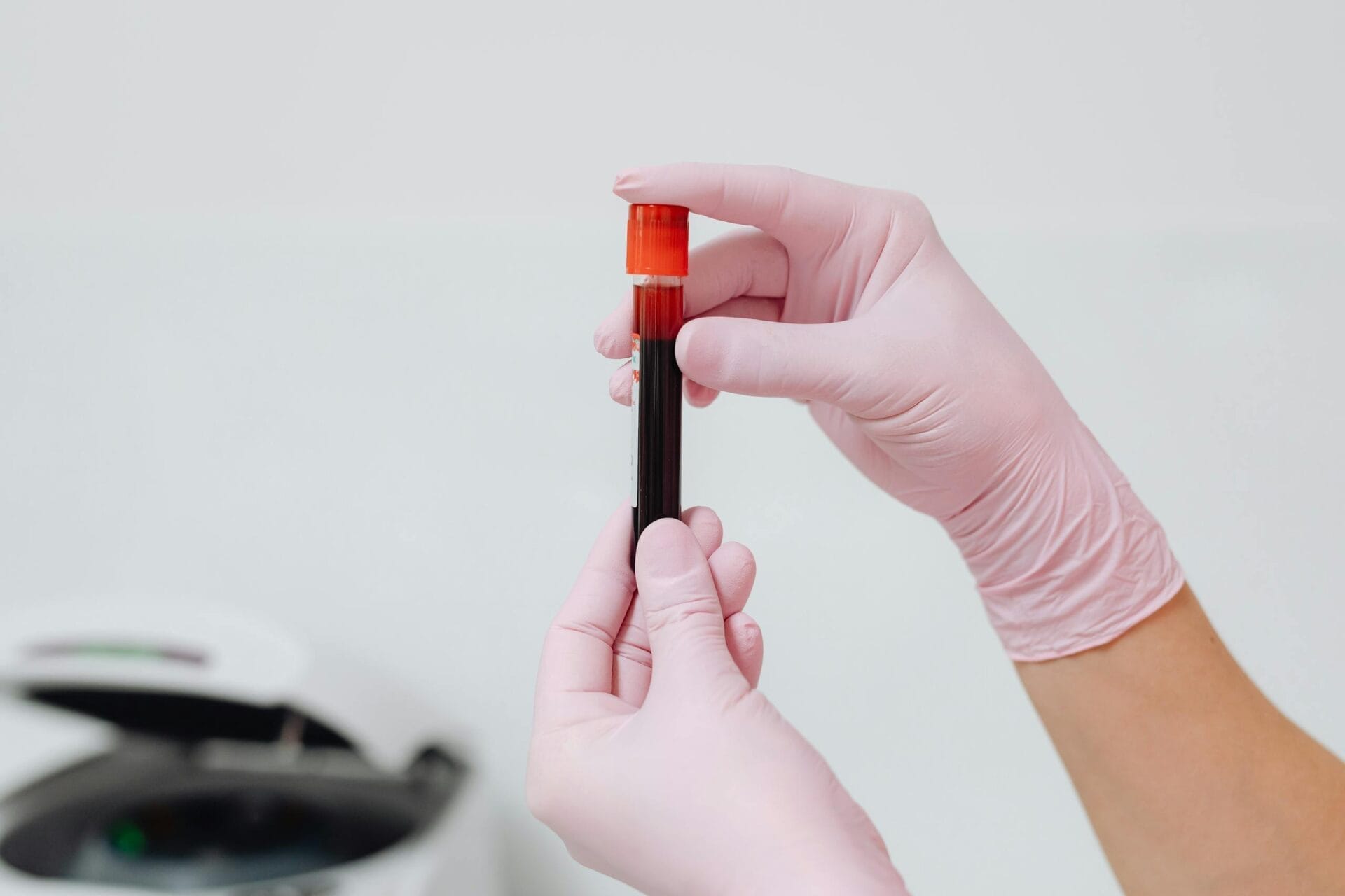 Close-up of gloved hands holding a blood sample in a test tube, ideal for medical and lab contexts.